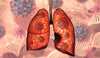 Terre de diatomée : un danger pour les poumons de l'homme ?